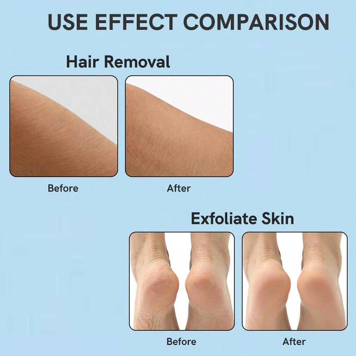 Nanohair Remover For Arms Legs Back One Sided Skin Hair Remover (1 Pc)