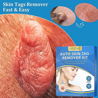Skintag Remover Kit 2 In 1 For Micro To Large (2 Mm - 8 Mm  1 Set)