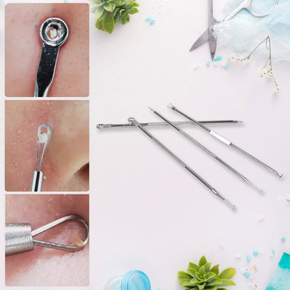 Blackhead Remover 4-In-1 Stainless Steel Pimple Extractor Tool (1 Pc)