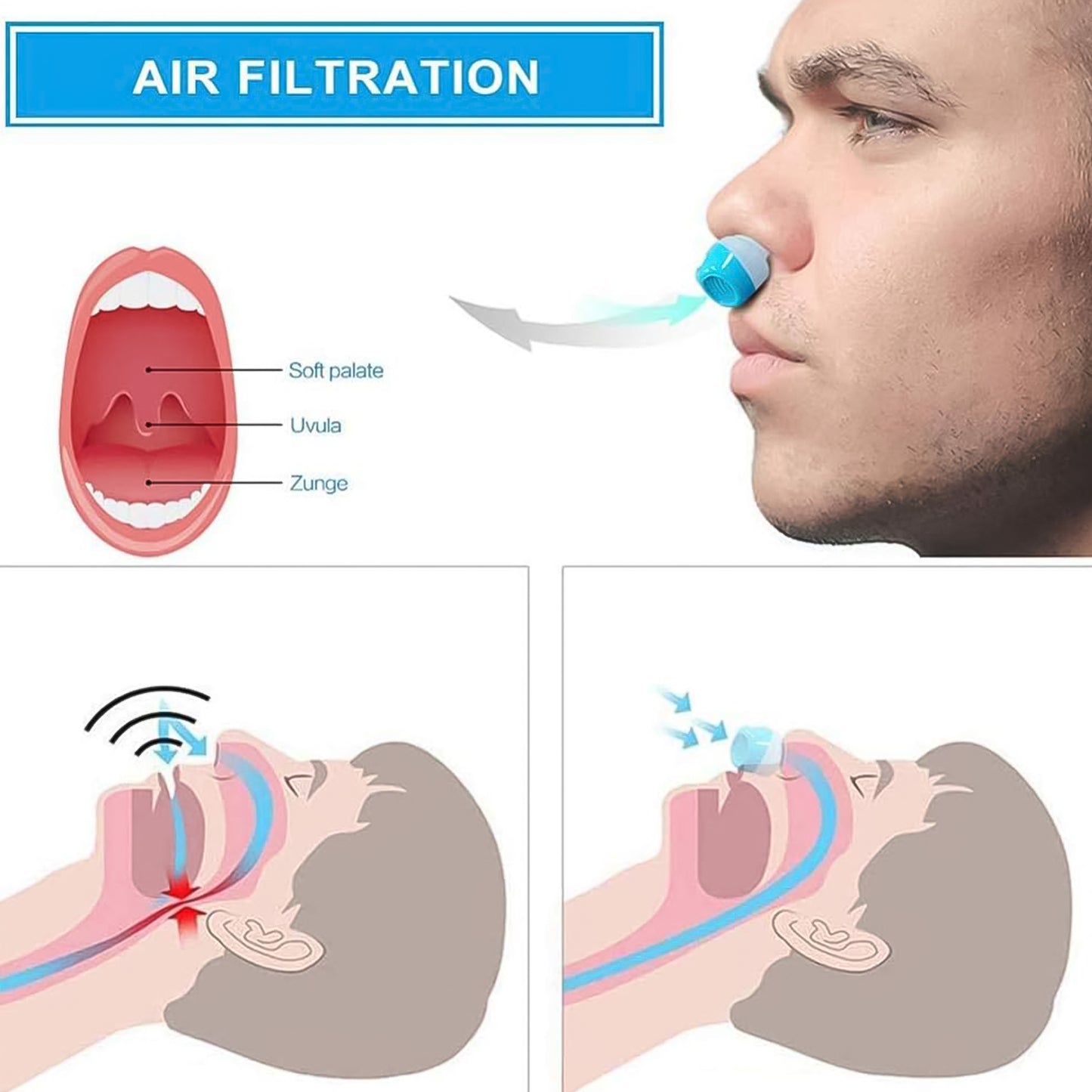 2 In1 Anti Snoring And Air Purifier Nose Clip Anti Snoring Device (1 Pc  With Plastic Case)