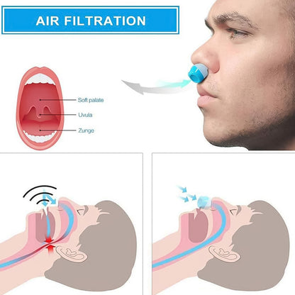 2 In1 Anti Snoring And Air Purifier Nose Clip Anti Snoring Device (1 Pc  With Plastic Case)